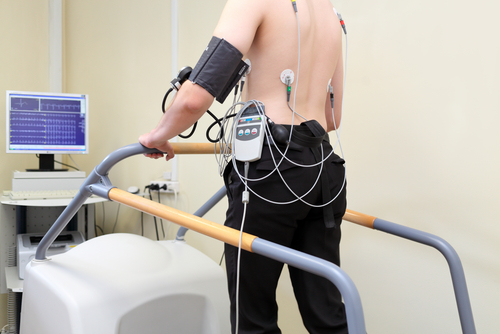 Pubblicati i primi dati dello studio ISCHEMIA