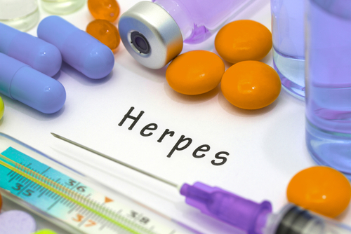 Aumento del rischio di herpes zoster negli adulti con asma