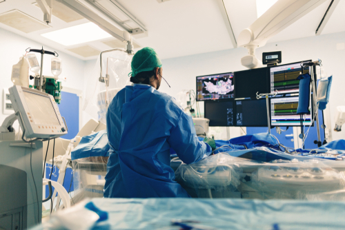 Stimolazione simpatica intravascolare per indurre PVC durante l’ablazione transcatetere