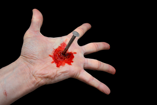 Stigmate religiose: approccio dermato-psichiatrico e diagnosi differenziale