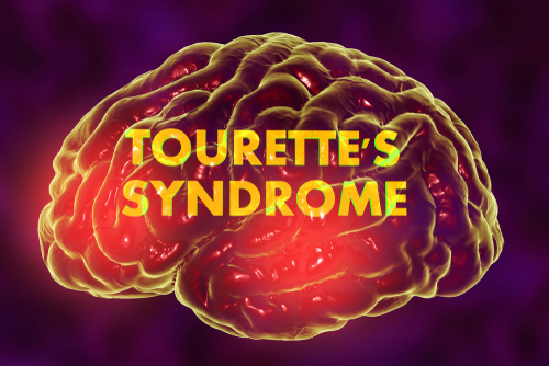 Sindrome di Tourette, i pazienti Aist: “Necessario accorciare gli iter diagnostici”