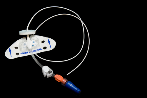 Nutrizione parenterale domiciliare: rapporto tra tipologia di catetere e infezioni