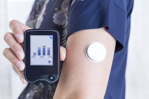 Diabete e CGM: nuova raccomandazione sui target “time in range”