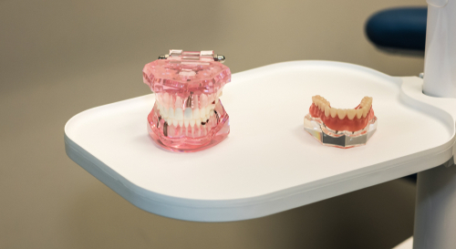 Caratteristiche morfologiche delle cisti radicolari alla TC