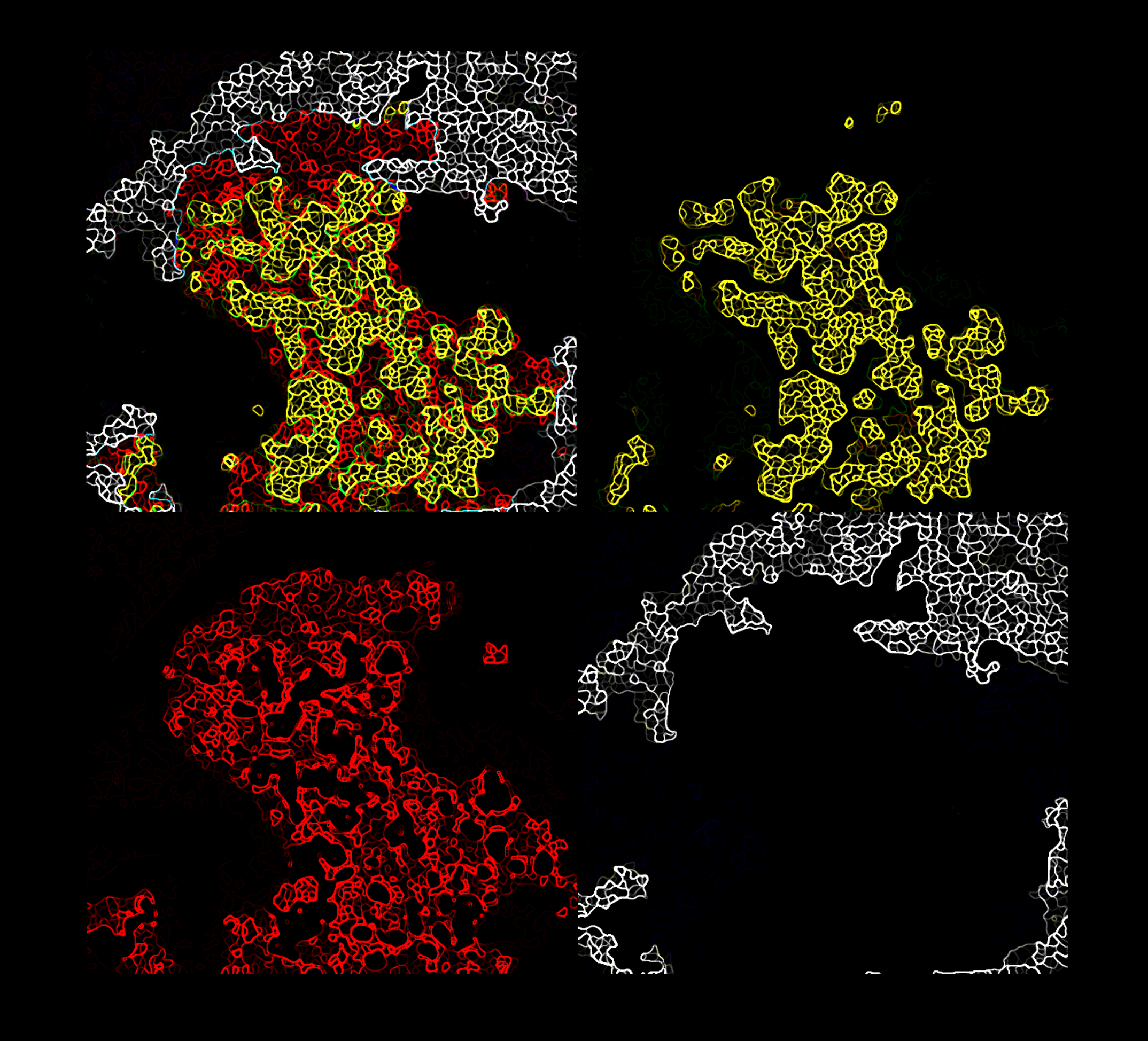 L’intervista – Scoperte delle cellule staminali nel “micro-ambiente” del tumore
