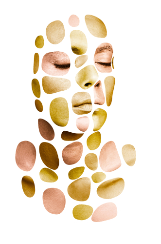 Acne. Ecco i fattori che contribuiscono a comparsa e gravità della malattia dermatologica