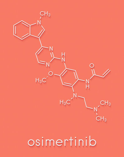Tumori polmonari: farmaco espande la sopravvivenza del 20% in alcuni pazienti