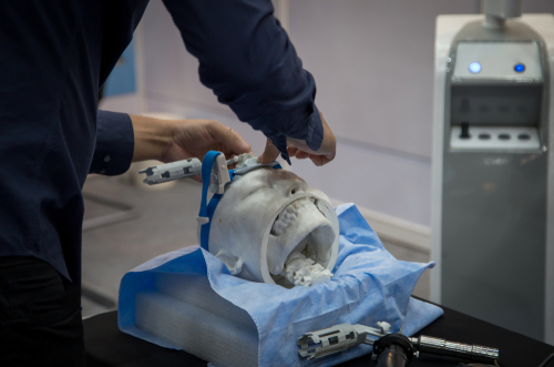 Melanomi e metastasi cerebrali: efficace terapia mirata con chirurgia stereotassica