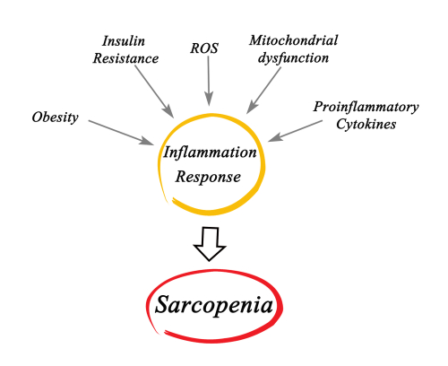 Sarcopenia negli anziani ricoverati per coronaropatie