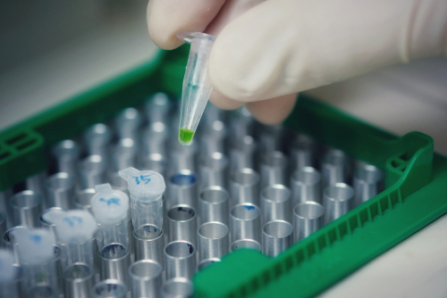 Infezioni pediatriche tratto respiratorio: miglior rilevamento virus con la PCR