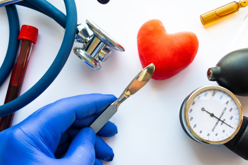 Efficace ritardo della vascolarizzazione basato sulla riserva di flusso frazionale