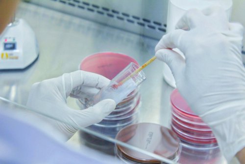 BPCO riacutizzata: purulenza dell’espettorato predice infezioni batteriche