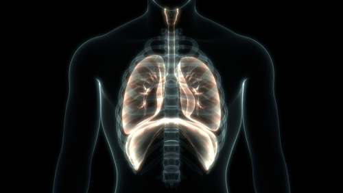 Pacemaker del diaframma e indipendenza respiratoria nelle persone con malattia di Pompe grave