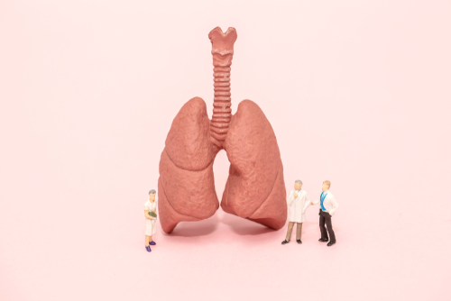 Effetto dell’esercizio fisico sull’affaticamento nel cancro polmonare avanzato