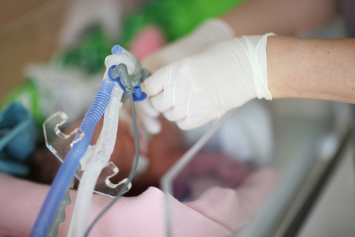 Intervenire sul dolore nelle procedure in TIN può migliorare esiti cognitivi e comportamentali