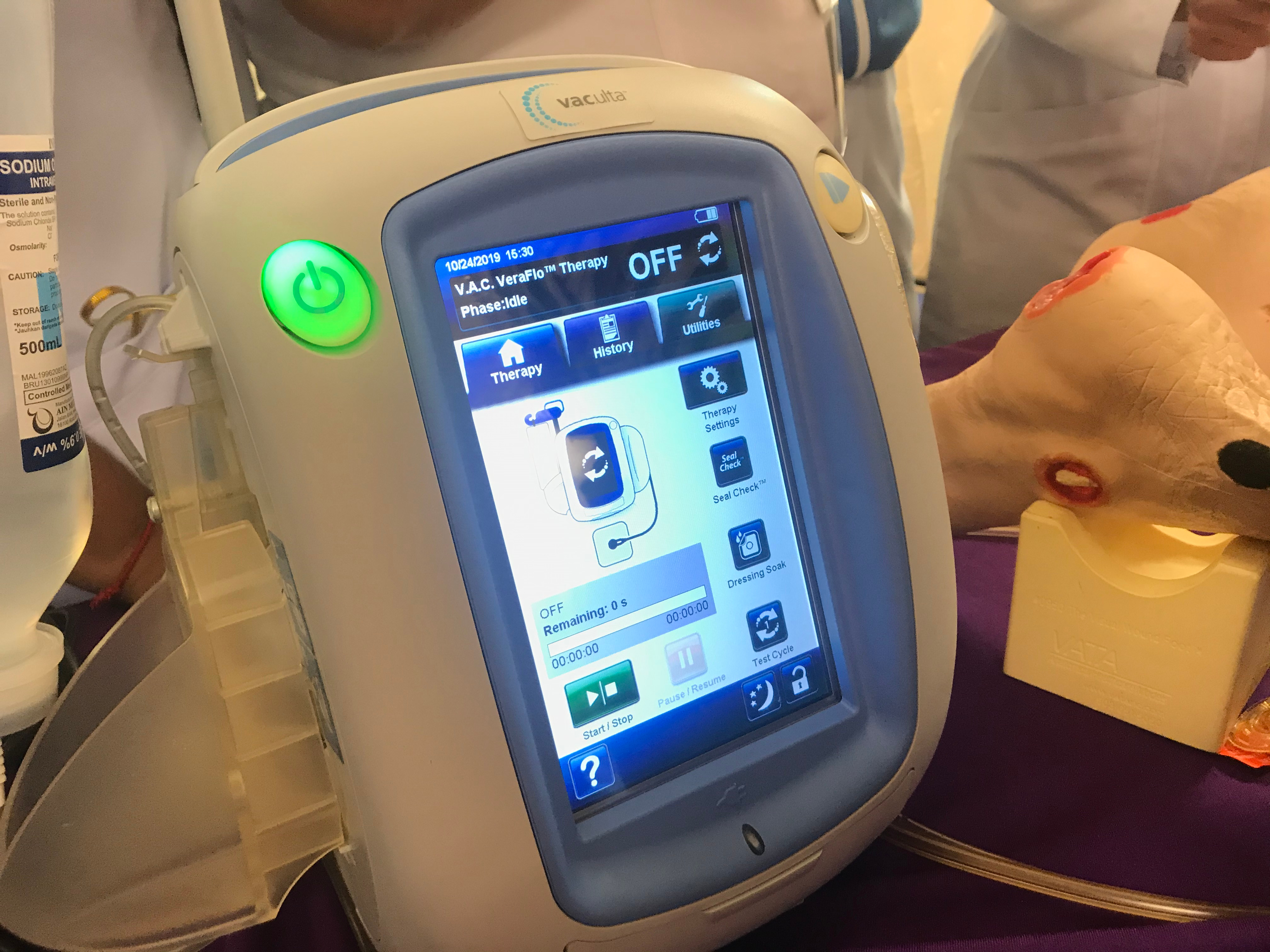 Chiusura post-operatoria ferite addominali: efficace terapia a pressione negativa