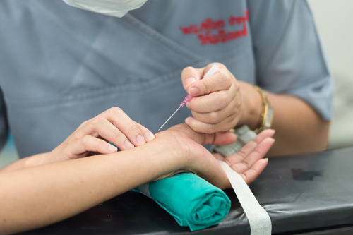 Coronaropatie acute ed accesso radiale per la PCI