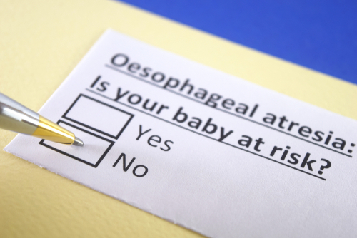 Atresia esofagea, stenosi anastomotiche e somministrazione di antiacidi