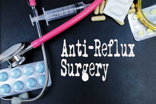 Chirurgia antireflusso per controllare i sintomi respiratori del reflusso stesso?