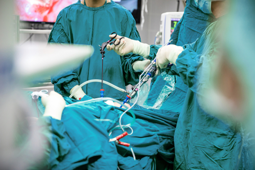 Tumori gastrointestinali stromali: la resezione R1 non comporta esiti più sfavorevoli della R0