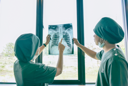 Covid-19 e tumori al polmone: i primi dati dello studio Teravolt