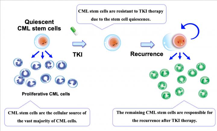 Leucemia mieloide cronica: identificato un gene coinvolto nelle recidive
