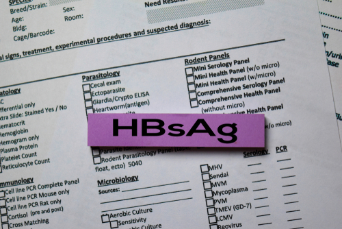 Epatite B cronica HbeAg+: composizione HbsAg predice la sua scomparsa con il trattamento