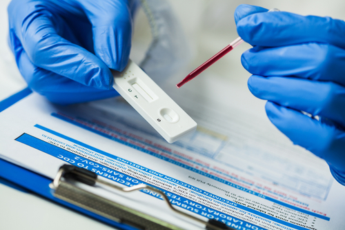 Stato dell’arte nei test sierologici per il CoVid-19