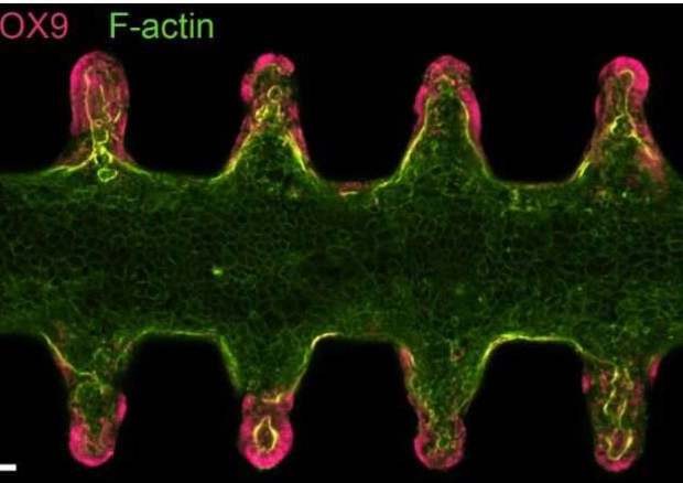 IBD: individuato possibile fattore scatenante dell’infiammazione cronica