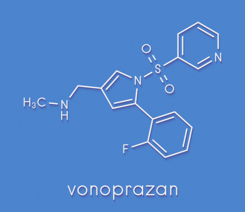 H. pylori: potenziali benefici del vonoprazan nel trattamento dell’infezione