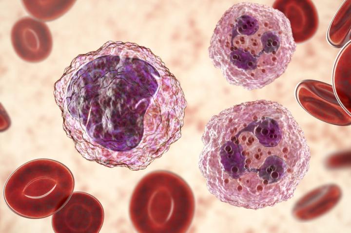 Revisione di sei trattamenti utilizzati per combattere la leucemia mieloide cronica