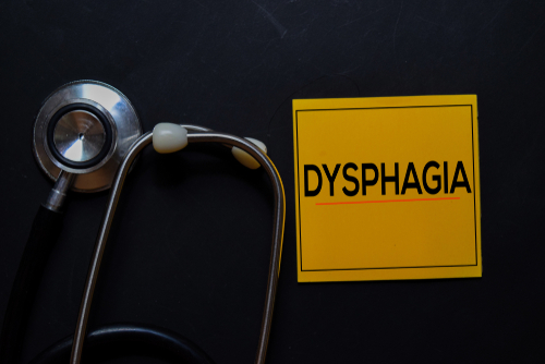 Disfagia neurogena: i benefici della stimolazione elettrica della faringe