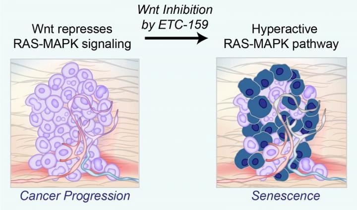 Tumori del pancreas e del colon-retto: un equilibrio tra crescita e senescenza cellulare