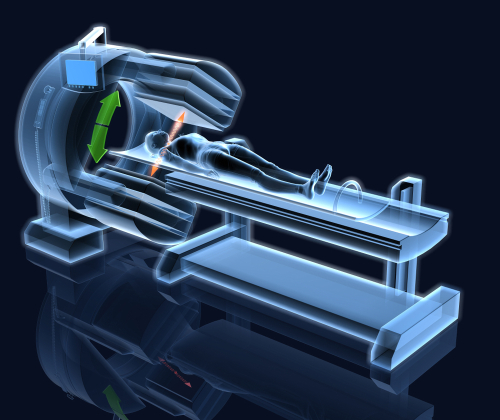 Scintigrafia presintomatica per l’amiloidosi ATTR: nuove prospettive diagnostiche