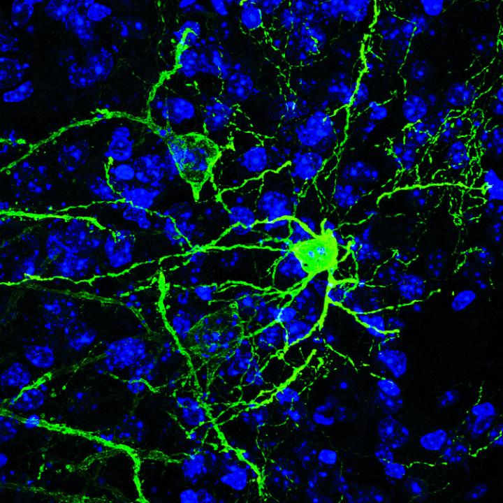 Identificati i neuroni coinvolti in ansia e paura