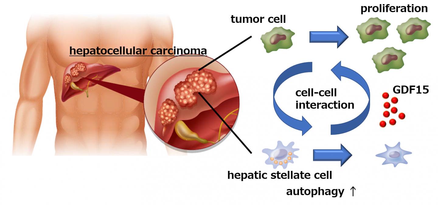 Trombocitopenia e sopravvivenza dei pazienti con carcinoma epatocellulare