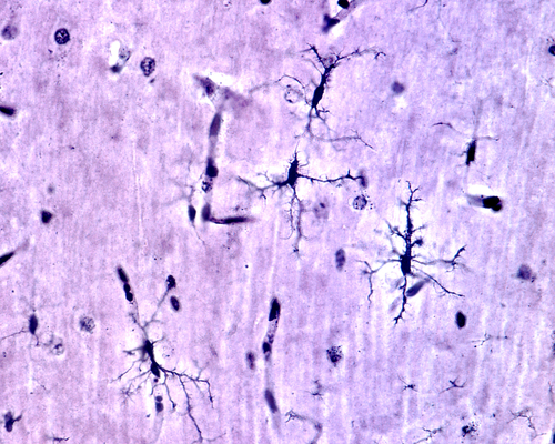 Microglia: il termostato del cervello