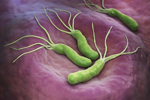 H.pylori: poca l’aderenza alle linee guida negli ospedali