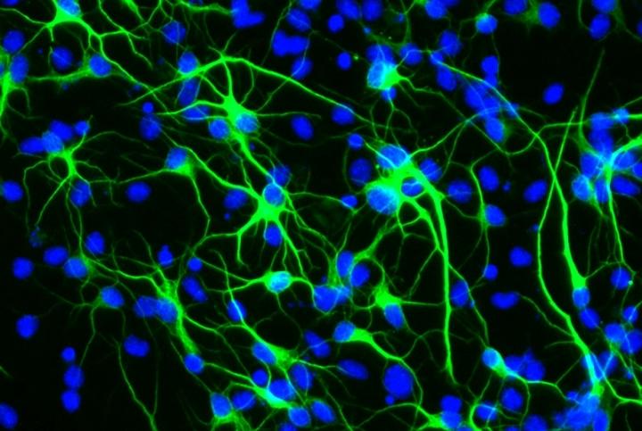 Il gene della longevità protegge i neuroni dallo stress