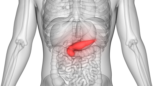 Effetti dell’integrazione di 1-chetosio nell’adenocarcinoma duttale pancreatico