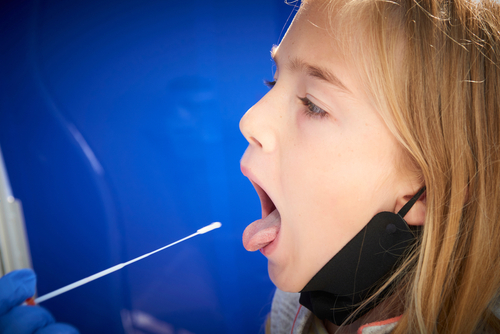 Complicazioni neurologiche del Covid-19 nei bambini