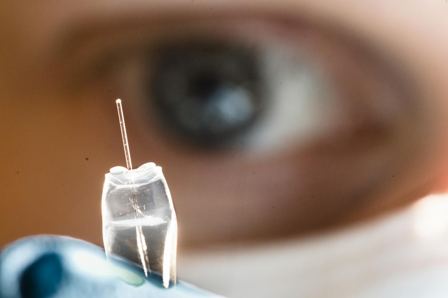 Una chemioterapia mirata per il glioblastoma