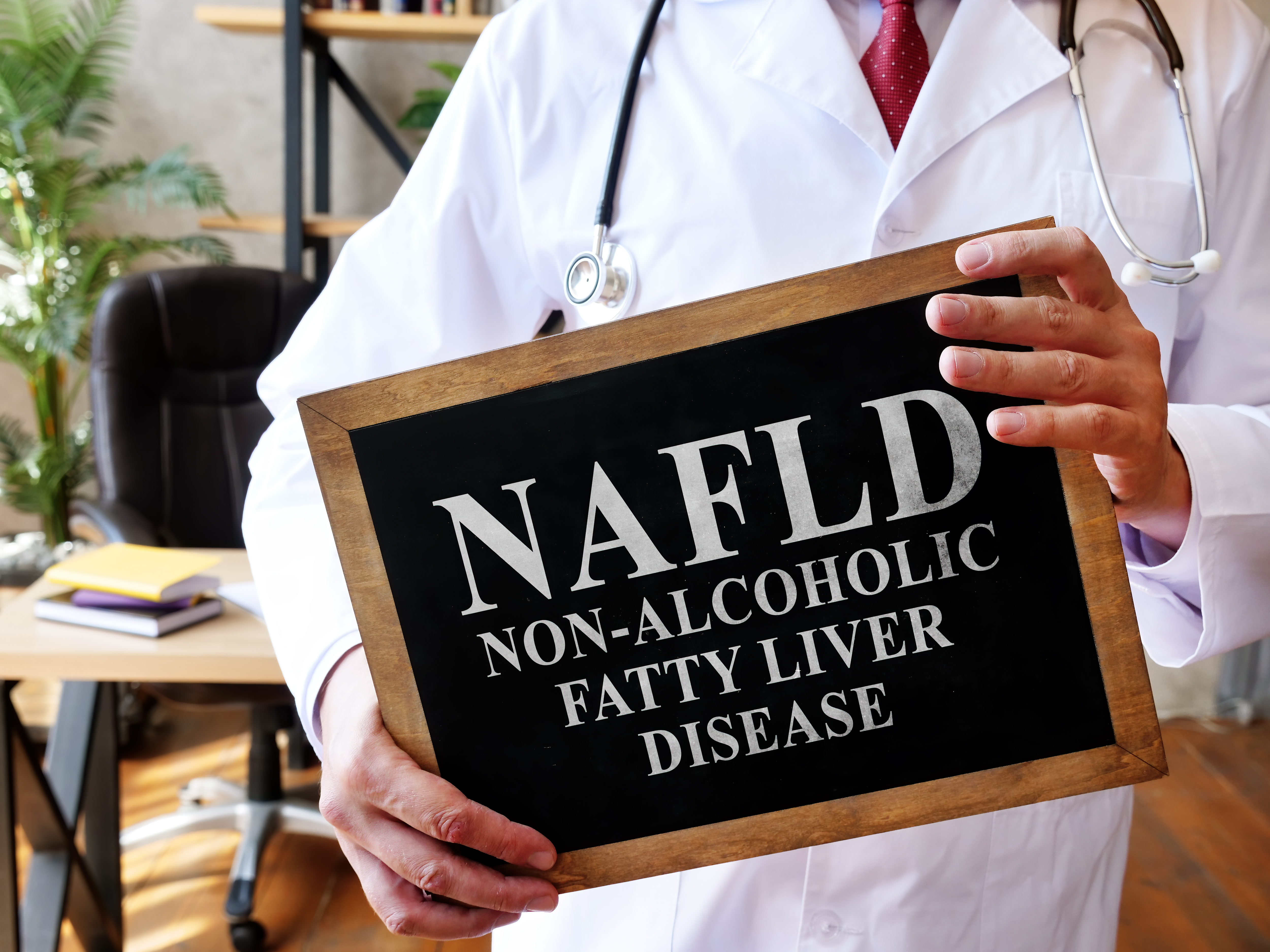 NAFLD associata a malattia di Crohn quiescente piuttosto che attiva