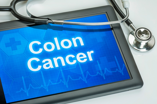 Cancro al colon-retto: i risultati italiani dello studio PRECONNECT