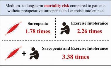 Tumore polmonare: sarcopenia e prestazioni fisiche preoperatorie influiscono sulla prognosi del paziente