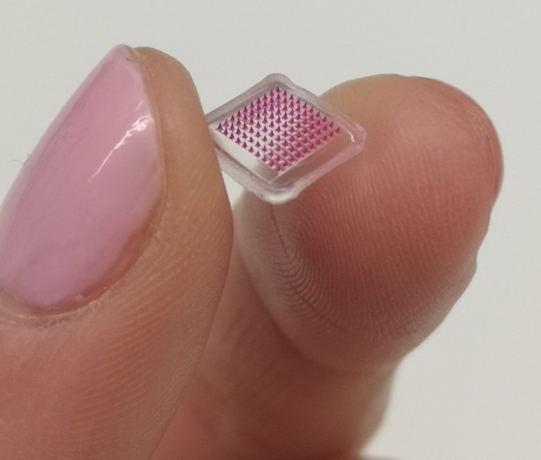 Il cerotto microneedle fornisce antibiotici localmente nella pelle