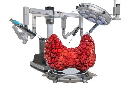 Tiroidectomia robotica transorale vs intervento tradizionale