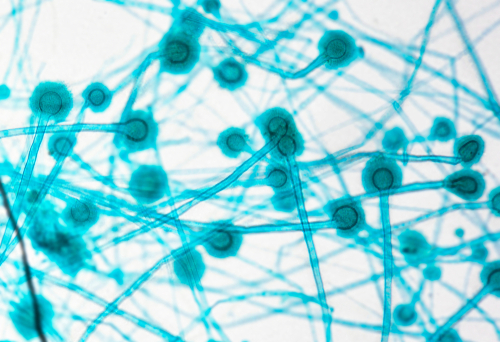 Infezioni fungine dopo guarigione dal COVID-19: revisione sistematica