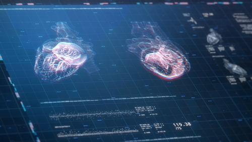 Ipertrofia ventricolare sinistra in ipertesi: la RM potrebbe non chiarire l’origine del problema