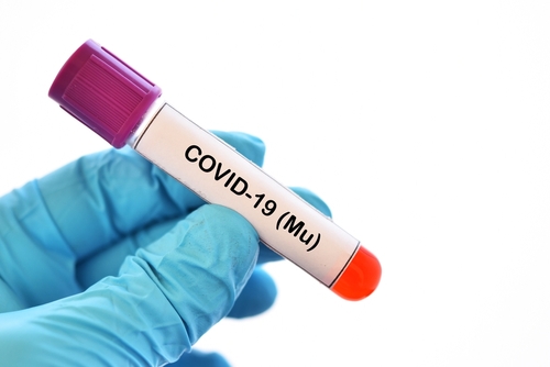 Malattia di Pompe: infezione da SARS-CoV-2 causa COVID-19 lieve